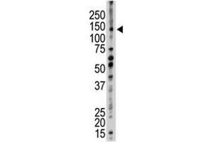 Image no. 1 for anti-Ubiquitin Conjugation Factor E4 B (UBE4B) (N-Term) antibody (ABIN357483) (UBE4B 抗体  (N-Term))