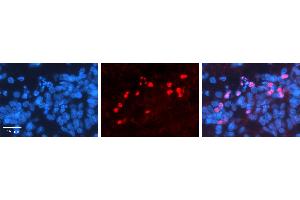 RORA antibody - middle region          Formalin Fixed Paraffin Embedded Tissue:  Human Pineal Tissue    Observed Staining:  Nucleus in Human Pineal Tissue   Primary Antibody Concentration:  1:100    Other Working Concentrations:  1/600    Secondary Antibody:  Donkey anti-Rabbit-Cy3    Secondary Antibody Concentration:  1:200    Magnification:  20X    Exposure Time:  0. (RORA 抗体  (Middle Region))