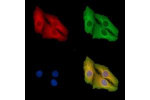 anti-phospholipase A2, Group V (PLA2G5) antibody
