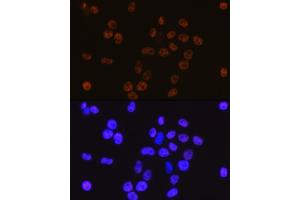 Immunofluorescence (IF) image for anti-Cyclin-Dependent Kinase 9 (CDK9) antibody (ABIN7266597)