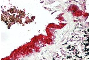 IHC Suggested Anti-MXI1 antibody  Titration: 5ug/ ml Positive Control: Lung, respiratory epithelium (MXI1 抗体  (Middle Region))
