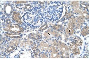 Rabbit Anti-SARDH Antibody  Paraffin Embedded Tissue: Human Kidney Cellular Data: Epithelial cells of renal tubule Antibody Concentration: 4. (SARDH 抗体  (Middle Region))