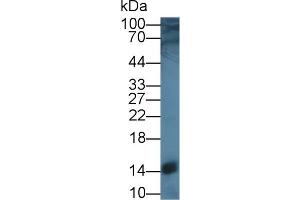 Western Blot; Sample: Rat Liver lysate; Primary Ab: 1µg/ml Rabbit Anti-Rat SCP2 Antibody Second Ab: 0. (SCP2 抗体  (AA 433-547))