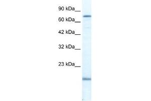 PGBD3 antibody used at 2. (PGBD3 抗体  (N-Term))