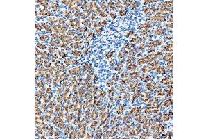 IHC analysis of RAB7/RAB7A using anti-RAB7/RAB7A antibody (ABIN7600597). (RAB7A 抗体  (AA 21-177))