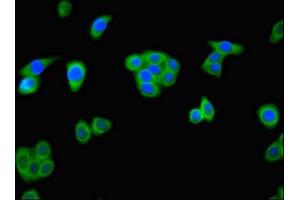 Immunofluorescent analysis of HepG2 cells using ABIN7143891 at dilution of 1:100 and Alexa Fluor 488-congugated AffiniPure Goat Anti-Rabbit IgG(H+L) (ALKBH4 抗体  (AA 1-115))