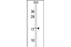 UBE2V2 Antibody (Center) (ABIN1538606 and ABIN2848850) western blot analysis in 293 cell line lysates (35 μg/lane). (UBE2V2 抗体  (AA 75-104))