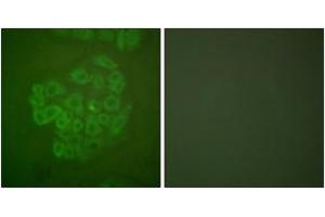 Immunofluorescence analysis of A549 cells, using GR (Ab-211) Antibody. (GR (AA 181-230) 抗体)