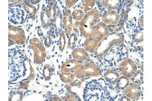 ApoBEC3D antibody was used for immunohistochemistry at a concentration of 12. (APOBEC3D 抗体)