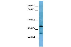 Western Blotting (WB) image for anti-Homeobox A6 (HOXA6) (N-Term) antibody (ABIN2779766) (HOXA6 抗体  (N-Term))