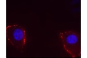 Immunocytochemistry (ICC) image for anti-Transient Receptor Potential Cation Channel, Subfamily V, Member 4 (TRPV4) (AA 647-662), (Extracellular) antibody (ABIN7043852)