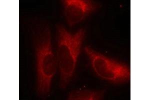 Immunofluorescence staining of methanol-fixed Hela cells using 14-3-3z(Phospho-Ser58) Antibody. (14-3-3 zeta 抗体  (pSer58))