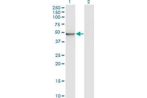 Western Blotting (WB) image for anti-Zinc Finger, MYND-Type Containing 10 (ZMYND10) (AA 1-440) antibody (ABIN526671)