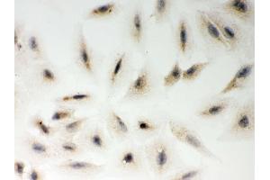 Immunohistochemistry (IHC) image for anti-Metadherin (MTDH) (AA 101-270) antibody (ABIN3043367)