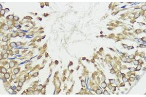Immunohistochemistry of paraffin-embedded Rat testis using HACE1 Polyclonal Antibody at dilution of 1:100 (40x lens). (HACE1 抗体)