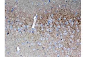 IHC analysis of SAP102 using anti-SAP102 antibody . (DLG3 抗体  (AA 749-817))