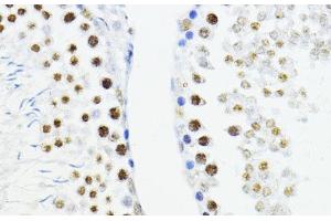 Immunohistochemistry of paraffin-embedded Rat testis using ZEB1 Polyclonal Antibody at dilution of 1:200 (40x lens). (ZEB1 抗体)