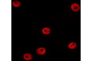 ABIN6274381 staining HepG2 by IF/ICC. (MAPK6 抗体  (Internal Region))