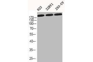 Western Blotting (WB) image for anti-Collagen, Type I, alpha 2 (COL1A2) (N-Term) antibody (ABIN7188641)