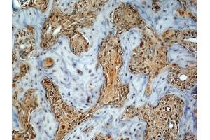 Generously provided by Markus Linder from Medical University Vienna as part of the Bioss Discovery Program. (Osteocalcin 抗体  (AA 21-80))