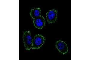 Confocal immunofluorescent analysis of NMB Antibody (Center) (ABIN651541 and ABIN2840290) with MDA-M cell followed by Alexa Fluor 488-conjugated goat anti-rabbit lgG (green). (Neuromedin B 抗体  (AA 15-42))