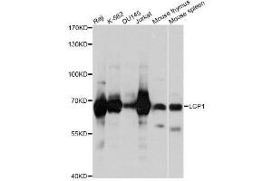 Western blot analysis of extracts of various cell lines, using LCP1 antibody. (LCP1 抗体  (AA 1-270))