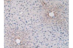 IHC-P analysis of Mouse Liver Tissue, with DAB staining. (Endoglin 抗体  (AA 27-137))