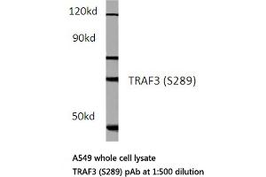 Western blot (WB) analysis of TCF-3 antibody in extracts from hela cells. (TCF3 抗体)