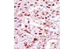 Image no. 2 for anti-Casein Kinase 2 alpha 1 (CSNK2A1) (Middle Region) antibody (ABIN360651) (CSNK2A1/CK II alpha 抗体  (Middle Region))