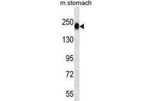Western Blotting (WB) image for anti-Tenascin N (TNN) antibody (ABIN2997436) (Tenascin N 抗体)