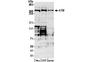Western Blotting (WB) image for anti-Ataxia Telangiectasia Mutated (ATM) (AA 1750-1800) antibody (ABIN7451570)