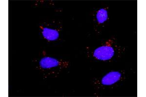 Proximity Ligation Assay (PLA) image for anti-Signal Transducer and Activator of Transcription 3 (Acute-Phase Response Factor) (STAT3) (AA 1-769) antibody (ABIN563027)
