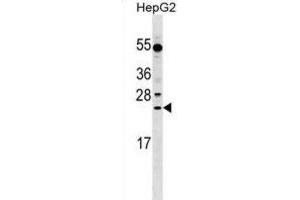 Western Blotting (WB) image for anti-Leucine Rich Repeat Containing 29 (LRRC29) antibody (ABIN2999686) (LRRC29 抗体)