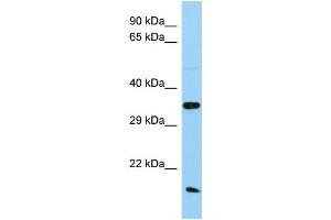 Host: Rabbit Target Name: Ak1 Sample Type: Rat Testis lysates Antibody Dilution: 1. (Adenylate Kinase 1 抗体  (Middle Region))