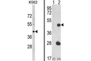 (LEFT) Western blot analysis of LUC7L Antibody (C-term) in K562 cell line lysates (35ug/lane). (LUC7L 抗体  (C-Term))