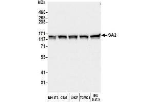 Western Blotting (WB) image for anti-Stromal Antigen 2 (STAG2) (AA 1125-1175) antibody (ABIN7453336)