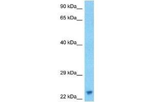 Host:  Rabbit  Target Name:  ASCL1  Sample Type:  RPMI-8226 Whole Cell lysates  Antibody Dilution:  1. (ASCL1 抗体  (N-Term))
