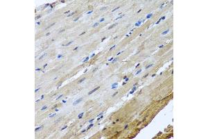 Immunohistochemistry of paraffin-embedded rat heart using NUMA1 antibody. (NUMA1 抗体)