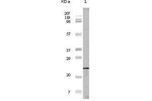 Western Blot showing 4E-BP1 antibody used against truncated 4E-BP1 recombinant protein (1). (eIF4EBP1 抗体)