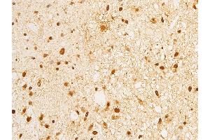 ABIN6267283 at 1/100 staining human brain tissue sections by IHC-P. (ErbB2/Her2 抗体  (pTyr1248))