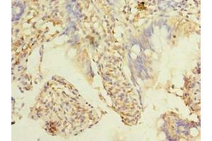 Immunohistochemistry of paraffin-embedded human small intestine tissue using ABIN7173386 at dilution of 1:100 (TMEM38B 抗体  (AA 249-291))