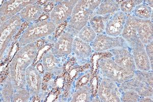 Immunohistochemistry of paraffin-embedded mouse kidney using Raptor Rabbit mAb (ABIN7269900) at dilution of 1:100 (40x lens). (Raptor 抗体)