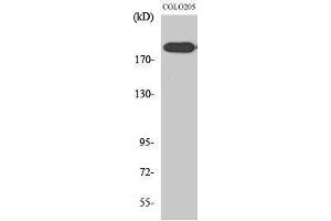 Western Blotting (WB) image for anti-DNA Repair Protein Complementing XP-G Cells (ERCC5) (N-Term) antibody (ABIN3187504) (ERCC5 抗体  (N-Term))
