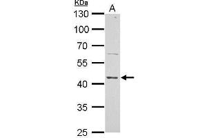 Western Blotting (WB) image for anti-Excision Repair Cross-Complementing Rodent Repair Deficiency, Complementation Group 8 (ERCC8) (Center) antibody (ABIN2857074)