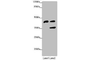 Western blot All lanes: SERPINB6 antibody at 0. (SERPINB6 抗体  (AA 180-300))