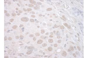 Immunohistochemistry (IHC) image for anti-Catenin, beta Like 1 (CTNNBL1) (AA 1-50) antibody (ABIN7448501) (CTNNBL1 抗体  (AA 1-50))