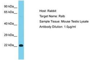 Image no. 1 for anti-V-Ral Simian Leukemia Viral Oncogene Homolog B (Ras Related, GTP Binding Protein) (Ralb) (AA 97-146) antibody (ABIN6750361) (RALB 抗体  (AA 97-146))
