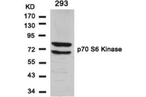 Image no. 3 for anti-Ribosomal Protein S6 Kinase, 70kDa, Polypeptide 1 (RPS6KB1) (Ser411) antibody (ABIN197526) (RPS6KB1 抗体  (Ser411))