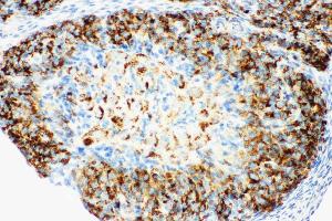 Immunohistochemistry (IHC) image for anti-Hydroxysteroid (17-Beta) Dehydrogenase 1 (HSD17B1) (AA 29-43), (N-Term) antibody (ABIN5518679)