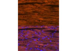 Immunofluorescence analysis of rat heart using Myosin heavy chain Rabbit mAb (ABIN7268750) at dilution of 1:100 (40x lens). (MYH7 抗体)